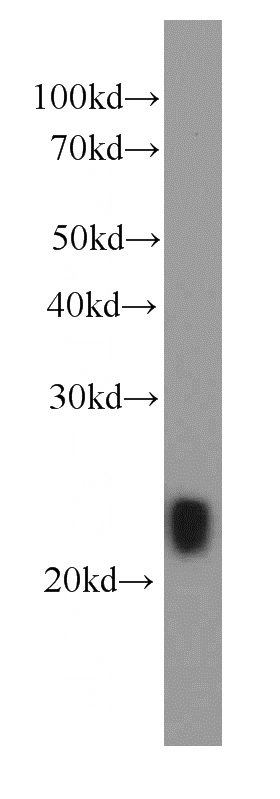 GST tagged recombinant IL29 protein were subjected to SDS PAGE followed by western blot with Catalog No:107397(IL29 Antibody) at dilution of 1:20000