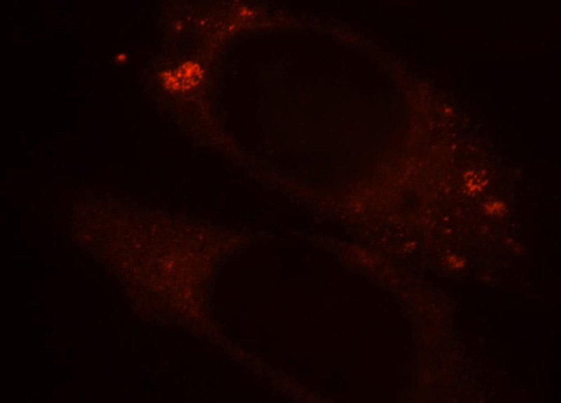 Immunofluorescent analysis of HepG2 cells, using BPI antibody Catalog No:117217 at 1:25 dilution and Rhodamine-labeled goat anti-rabbit IgG (red).