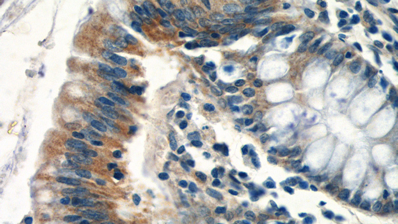 Immunohistochemistry of paraffin-embedded human colon tissue slide using Catalog No:111954(ITM2C Antibody) at dilution of 1:50 (under 40x lens)