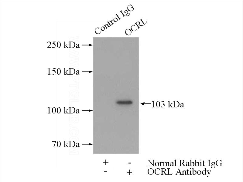 IP Result of anti-ocRL (IP:Catalog No:113468, 4ug; Detection:Catalog No:113468 1:300) with HeLa cells lysate 1080ug.