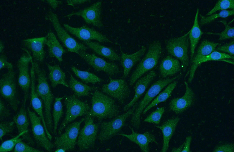 Immunofluorescent analysis of SH-SY5Y cells using Catalog No:116293(APRIL,TNFSF13 Antibody) at dilution of 1:25 and Alexa Fluor 488-congugated AffiniPure Goat Anti-Rabbit IgG(H+L)