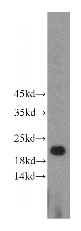 HeLa cells were subjected to SDS PAGE followed by western blot with Catalog No:111385(HDDC3 antibody) at dilution of 1:500