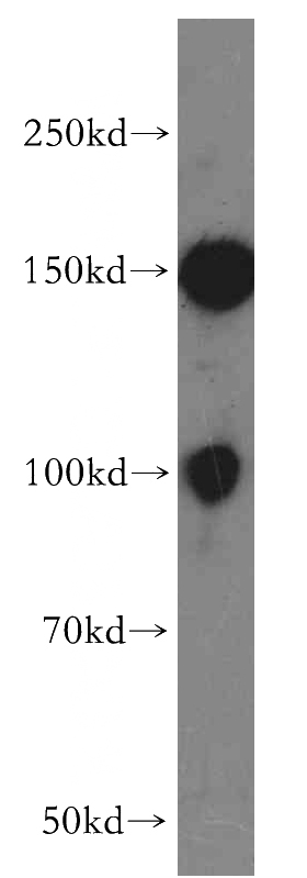 Jurkat cells were subjected to SDS PAGE followed by western blot with Catalog No:115511(SOX13 antibody) at dilution of 1:500