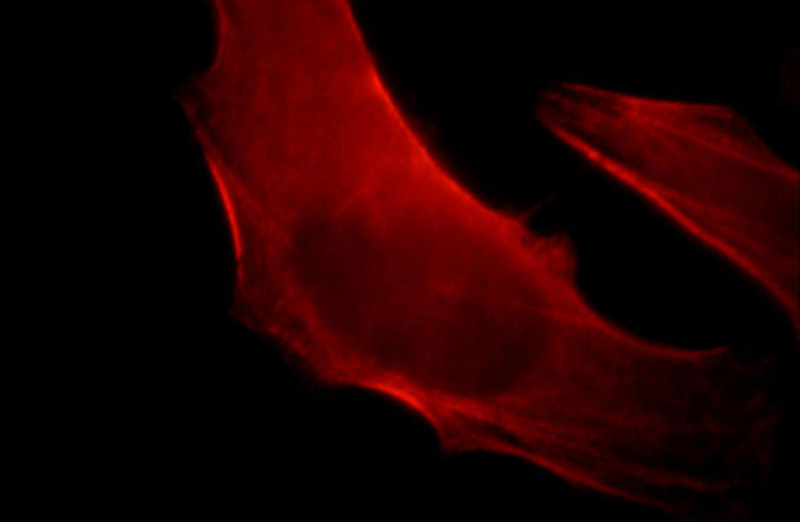 Immunofluorescent analysis of HepG2 cells, using CNN2 antibody Catalog No:109427 at 1:25 dilution and Rhodamine-labeled goat anti-rabbit IgG (red).