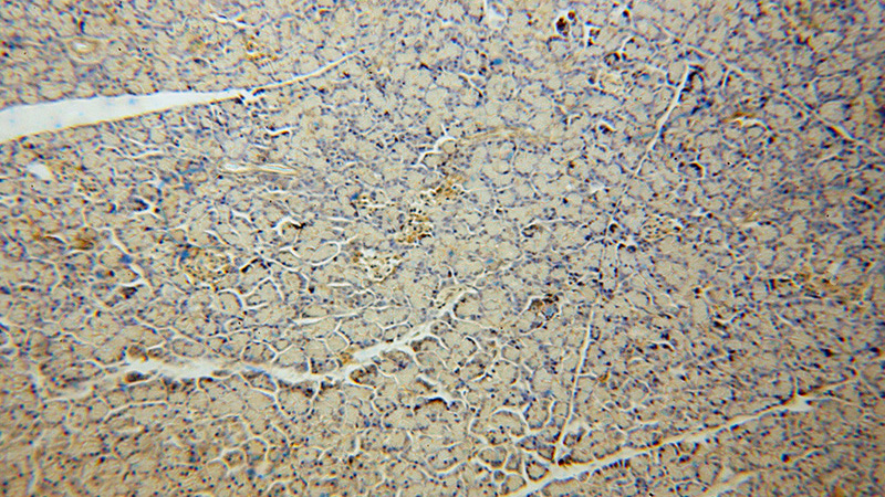 Immunohistochemical of paraffin-embedded human pancreas using Catalog No:107841(AGXT2L2 antibody) at dilution of 1:50 (under 10x lens)