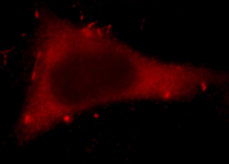 Immunofluorescent analysis of Hela cells, using HECTD1 antibody Catalog No:111396 at 1:25 dilution and Rhodamine-labeled goat anti-rabbit IgG (red).