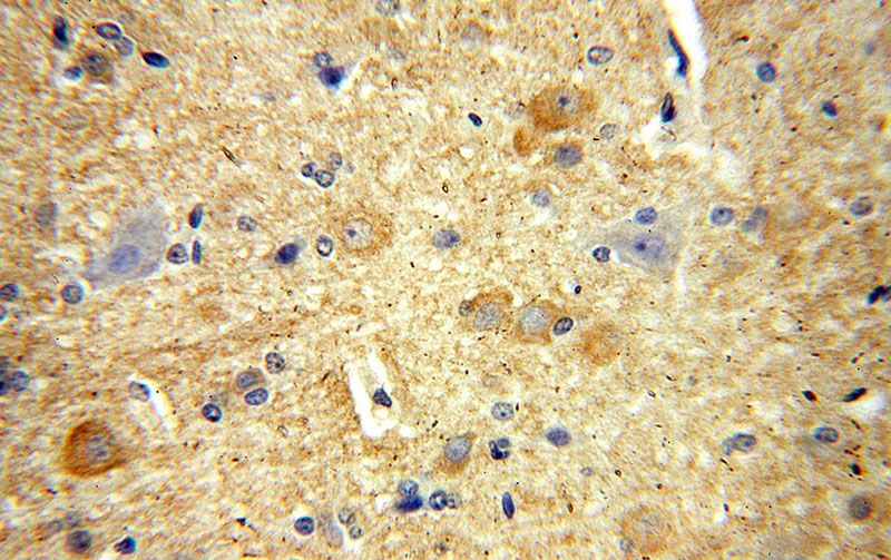 Immunohistochemical of paraffin-embedded human brain using Catalog No:114875(RPL19 antibody) at dilution of 1:100 (under 40x lens)