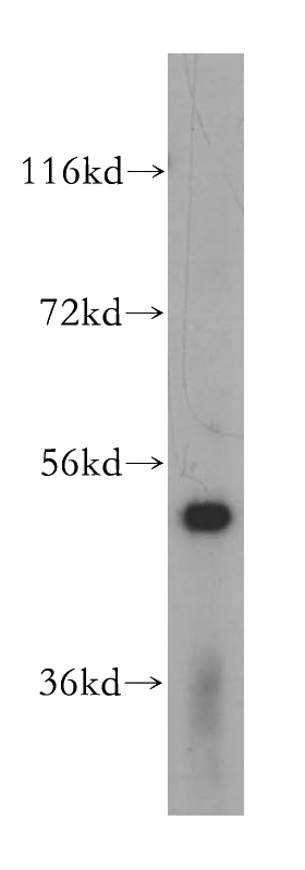 A549 cells were subjected to SDS PAGE followed by western blot with Catalog No:114342(PUS3 antibody) at dilution of 1:500