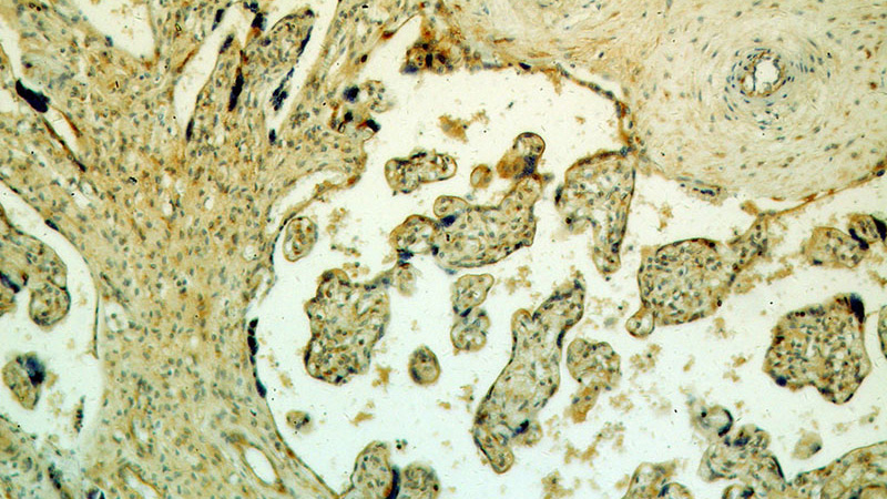 Immunohistochemical of paraffin-embedded human placenta using Catalog No:112991(MYOF antibody) at dilution of 1:100 (under 10x lens)