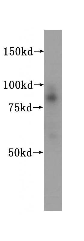 HeLa cells were subjected to SDS PAGE followed by western blot with Catalog No:115610(SSRP1 antibody) at dilution of 1:500