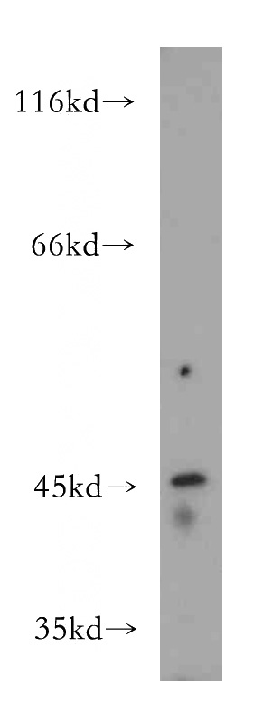 Jurkat cells were subjected to SDS PAGE followed by western blot with Catalog No:112218(LHX5 antibody) at dilution of 1:300