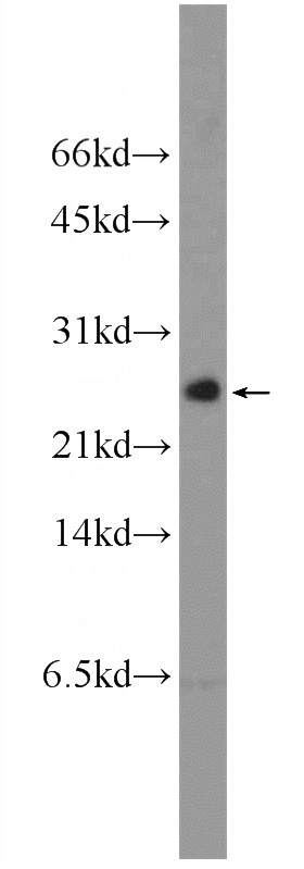 mouse testis tissue were subjected to SDS PAGE followed by western blot with Catalog No:110262(EIF4EBP2 Antibody) at dilution of 1:300