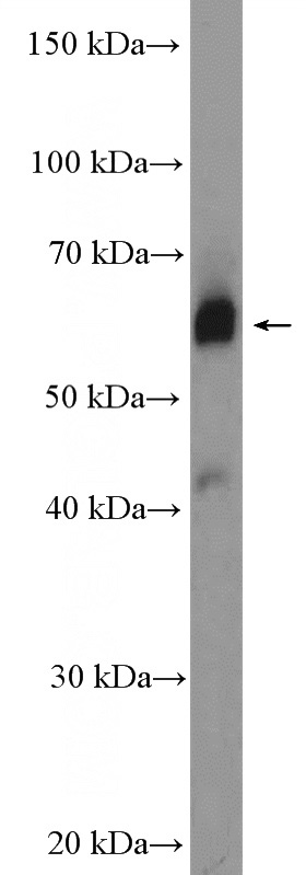 mouse small intestine tissue were subjected to SDS PAGE followed by western blot with Catalog No:116952(ZNF169 Antibody) at dilution of 1:600