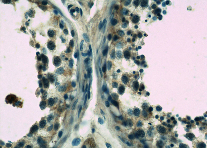 Immunohistochemistry of paraffin-embedded human testis slide using Catalog No:116815(WDR7 Antibody) at dilution of 1:50