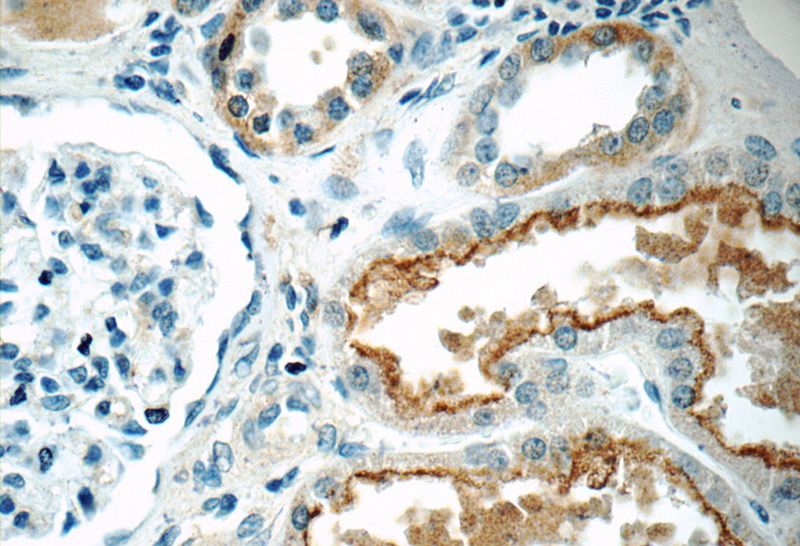 Immunohistochemistry of paraffin-embedded human kidney tissue slide using Catalog No:111299(HERPUD2 Antibody) at dilution of 1:50 (under 40x lens)