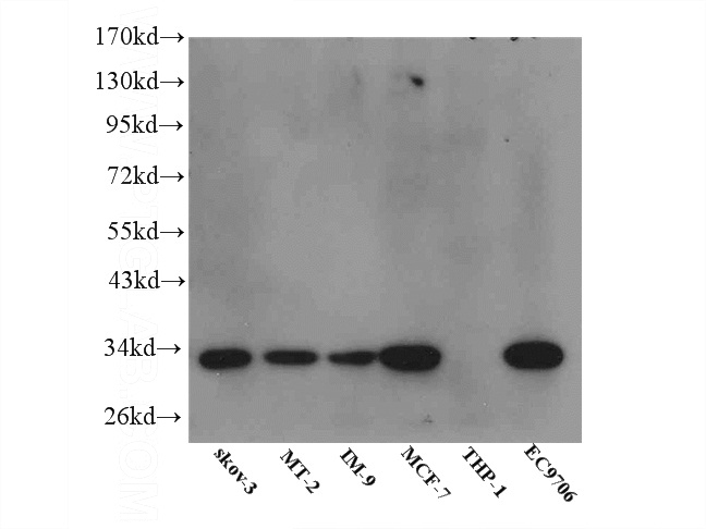 WB result of Catalog No:111688 (IGFBP5 Antibody) at dilution of 1:500.