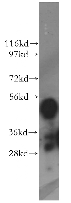 HeLa cells were subjected to SDS PAGE followed by western blot with Catalog No:112260(KYNU antibody) at dilution of 1:2000