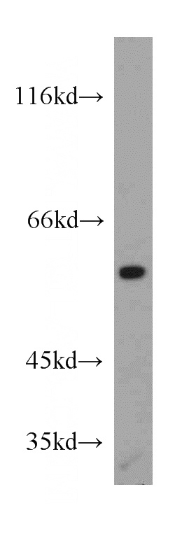 HeLa cells were subjected to SDS PAGE followed by western blot with Catalog No:116864(WDR37 antibody) at dilution of 1:300