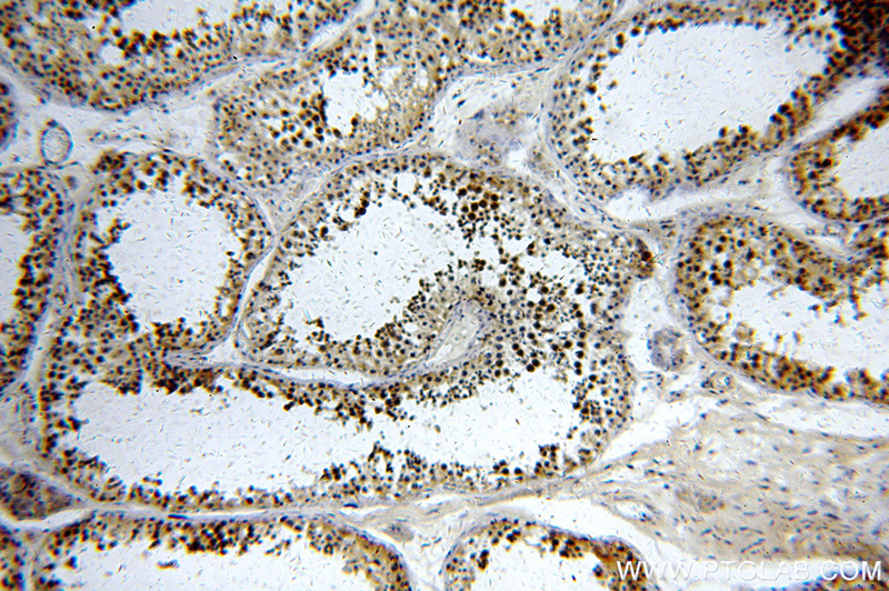 Immunohistochemical of paraffin-embedded human testis using Catalog No:107855(AIM2 antibody) at dilution of 1:100 (under 10x lens)