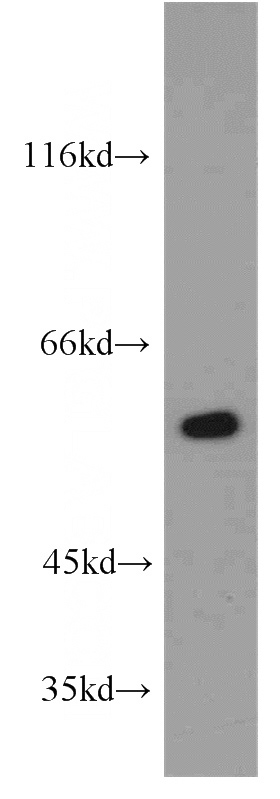 mouse brain tissue were subjected to SDS PAGE followed by western blot with Catalog No:114111(PPP3CB antibody) at dilution of 1:300