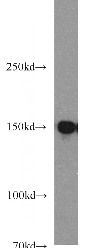 HeLa cells were subjected to SDS PAGE followed by western blot with Catalog No:114796(RPAP1 antibody) at dilution of 1:800