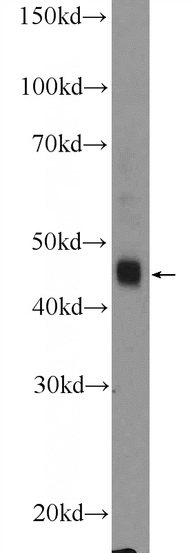 HeLa cells were subjected to SDS PAGE followed by western blot with Catalog No:110204(EFCAB4B Antibody) at dilution of 1:600