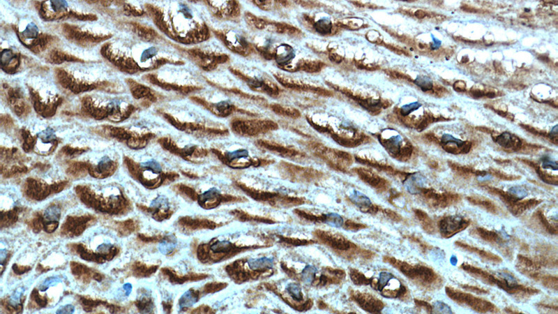 Immunohistochemical of paraffin-embedded human cervix using Catalog No:109983(DKK2 antibody) at dilution of 1:50 (under 40x lens)
