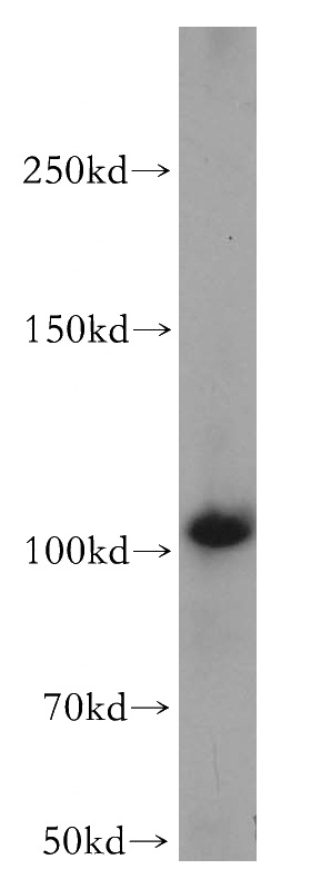 A431 cells were subjected to SDS PAGE followed by western blot with Catalog No:112435(MAPK6 antibody) at dilution of 1:500
