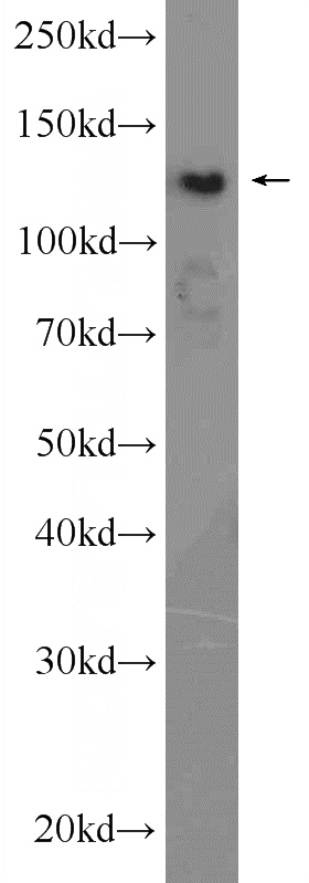 HeLa cells were subjected to SDS PAGE followed by western blot with Catalog No:111378(HDAC4-specific Antibody) at dilution of 1:600