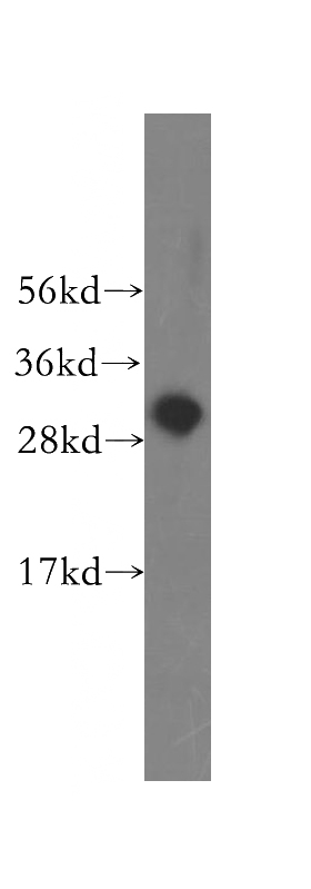 human lung tissue were subjected to SDS PAGE followed by western blot with Catalog No:115395(SMNDC1 antibody) at dilution of 1:400
