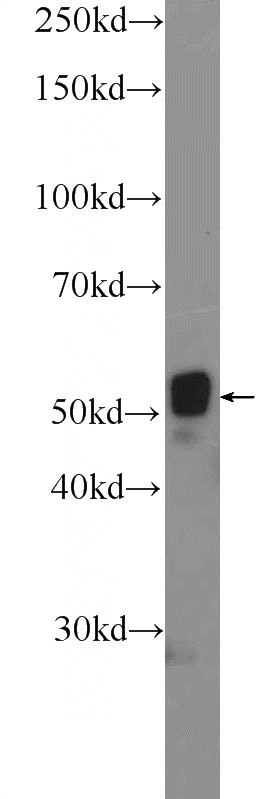 MCF-7 cells were subjected to SDS PAGE followed by western blot with Catalog No:109685(CYP1B1 Antibody) at dilution of 1:600