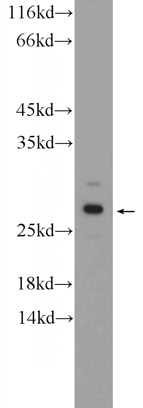 mouse liver tissue were subjected to SDS PAGE followed by western blot with Catalog No:112291(Loc123688 Antibody) at dilution of 1:600