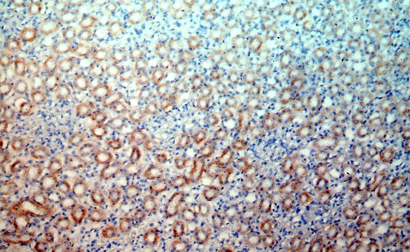 Immunohistochemical of paraffin-embedded human kidney using Catalog No:114158(PPT1 antibody) at dilution of 1:50 (under 10x lens)