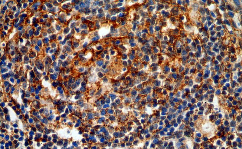 Immunohistochemical of paraffin-embedded human spleen using Catalog No:116290(TNFR2 antibody) at dilution of 1:50 (under 40x lens)