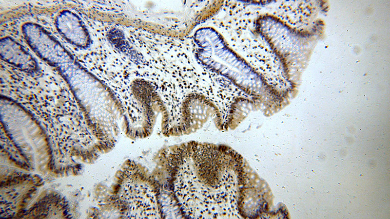 Immunohistochemical of paraffin-embedded human colon using Catalog No:112763(MTA2 antibody) at dilution of 1:100 (under 10x lens)