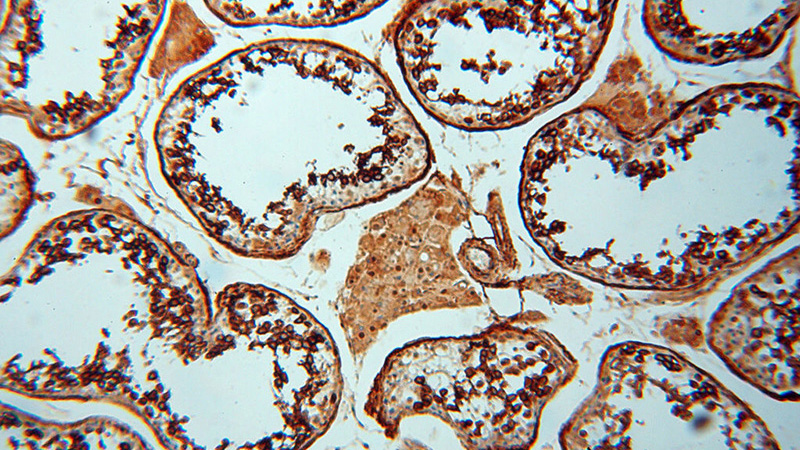 Immunohistochemical of paraffin-embedded human testis using Catalog No:109736(CTTNBP2 antibody) at dilution of 1:100 (under 10x lens)