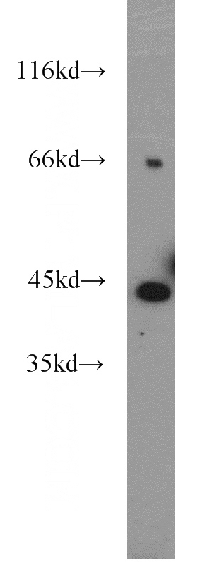mouse testis tissue were subjected to SDS PAGE followed by western blot with Catalog No:108204(ART3 antibody) at dilution of 1:800