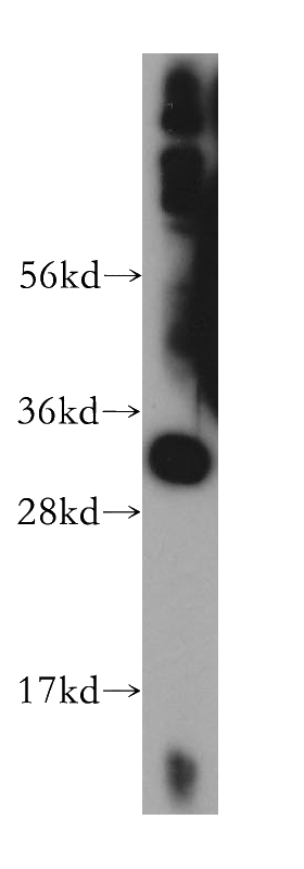 mouse skeletal muscle tissue were subjected to SDS PAGE followed by western blot with Catalog No:115336(SLC25A45 antibody) at dilution of 1:400