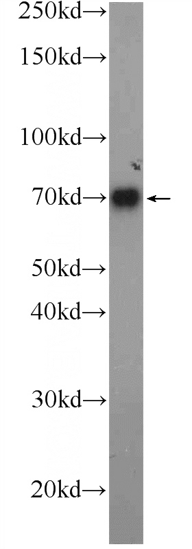 human blood tissue were subjected to SDS PAGE followed by western blot with Catalog No:108728(C4BPA Antibody) at dilution of 1:600