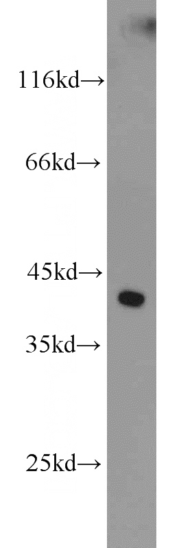 mouse kidney tissue were subjected to SDS PAGE followed by western blot with Catalog No:110713(FOXQ1 antibody) at dilution of 1:800