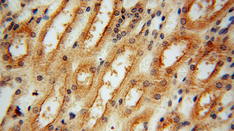Immunohistochemical of paraffin-embedded human kidney using Catalog No:114359(PYGL antibody) at dilution of 1:100 (under 40x lens)