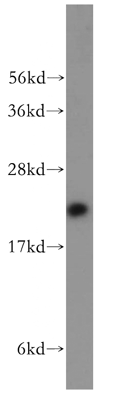 Jurkat cells were subjected to SDS PAGE followed by western blot with Catalog No:112725(MocS2 antibody) at dilution of 1:200