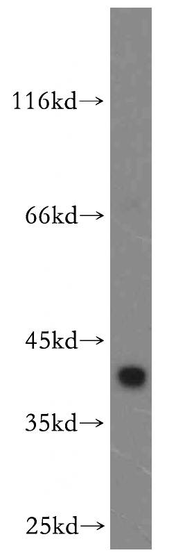 mouse liver tissue were subjected to SDS PAGE followed by western blot with Catalog No:114485(RASSF8 antibody) at dilution of 1:100