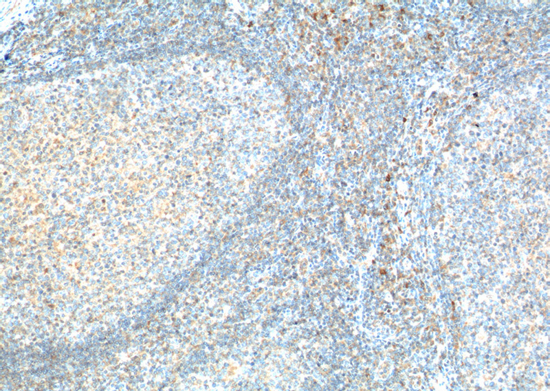 Immunohistochemistry of paraffin-embedded human tonsillitis tissue slide using Catalog No:109009(CD226 Antibody) at dilution of 1:200 (under 10x lens). heat mediated antigen retrieved with Tris-EDTA buffer(pH9).