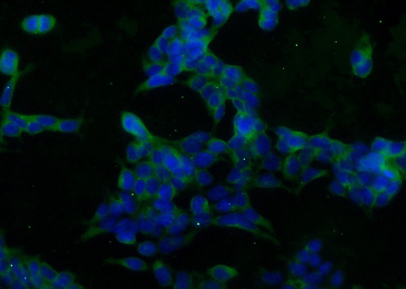 Immunofluorescent analysis of HEK-293 cells using Catalog No:115492(SOD1 Antibody) at dilution of 1:25 and Alexa Fluor 488-congugated AffiniPure Goat Anti-Rabbit IgG(H+L)