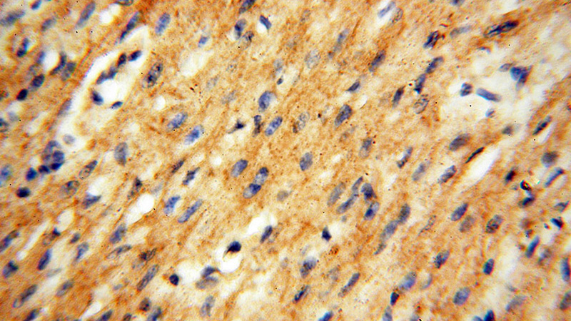 Immunohistochemical of paraffin-embedded human heart using Catalog No:116680(USP38 antibody) at dilution of 1:50 (under 40x lens)