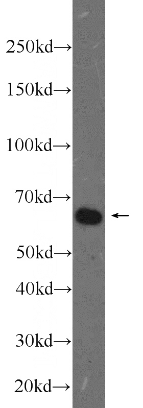 K-562 cells were subjected to SDS PAGE followed by western blot with Catalog No:116681(USP39 antibody) at dilution of 1:1000