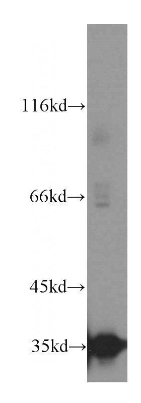 human testis tissue were subjected to SDS PAGE followed by western blot with Catalog No:112186(LDHC antibody) at dilution of 1:300