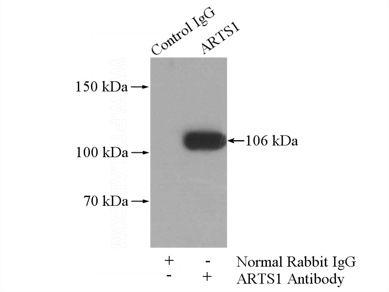 IP Result of anti-ERAP1 (IP:Catalog No:108206, 4ug; Detection:Catalog No:108206 1:600) with Jurkat cells lysate 3600ug.