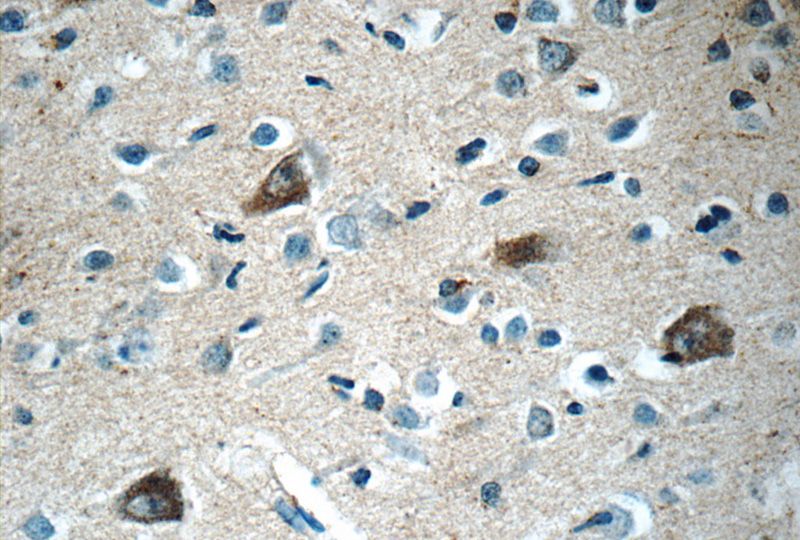 Immunohistochemistry of paraffin-embedded human brain tissue slide using Catalog No:114692(RERG Antibody) at dilution of 1:50 (under 40x lens)